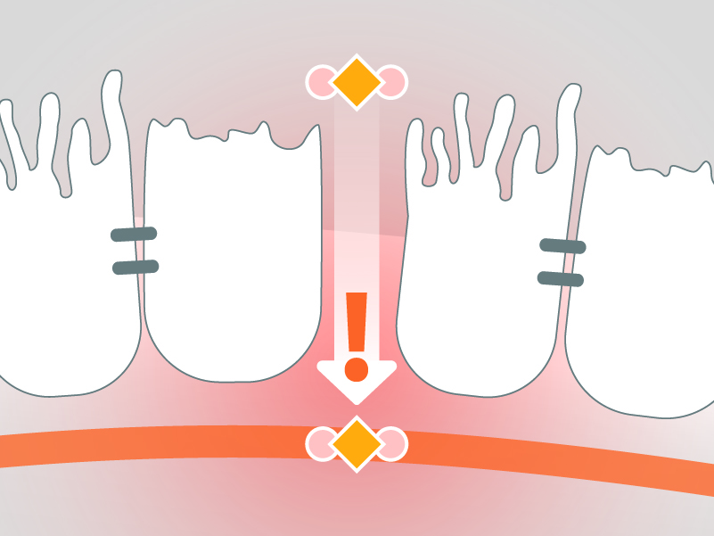 ETS-Intestinal-lumen-with-LPS-Website